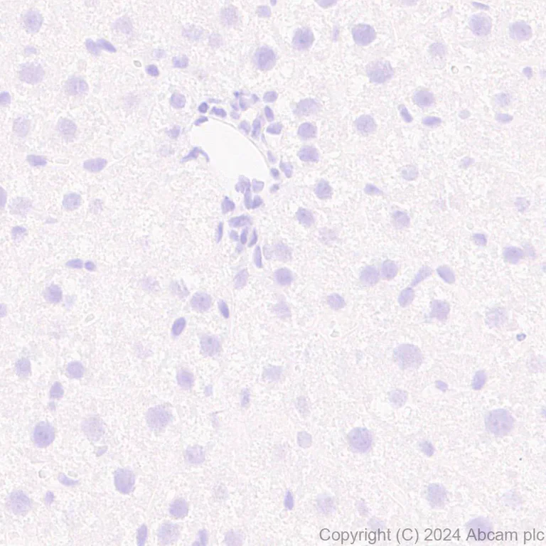 Immunohistochemistry (Formalin/PFA-fixed paraffin-embedded sections) - Anti-RIM1 antibody [EPR29131-30] (AB317450)