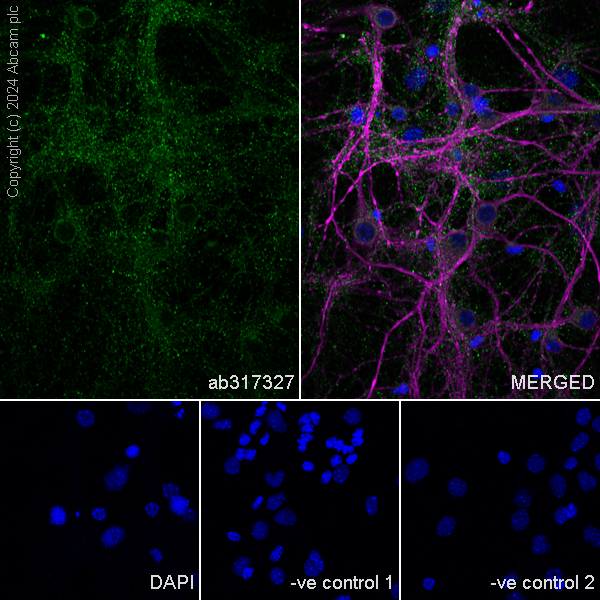 Immunocytochemistry/ Immunofluorescence - Anti-RIM1 antibody [EPR29131-34] - BSA and Azide free (AB317328), expandable thumbnail