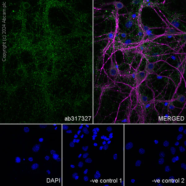 Immunocytochemistry/ Immunofluorescence - Anti-RIM1 antibody [EPR29131-34] - BSA and Azide free (AB317328)