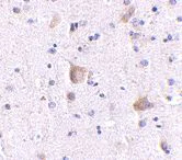 Immunohistochemistry (Formalin/PFA-fixed paraffin-embedded sections) - Anti-RIM2 antibody (AB69860)