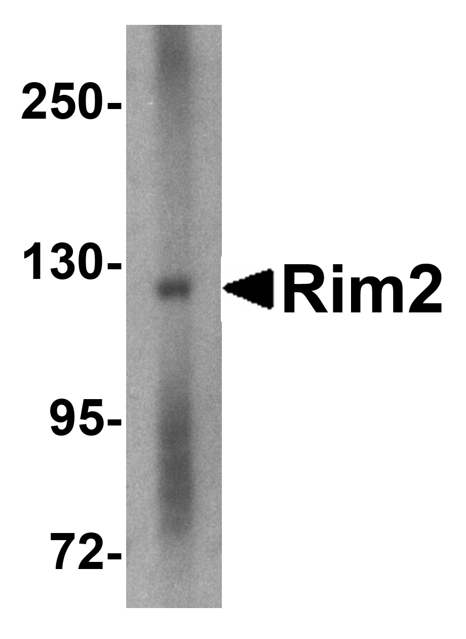 Western blot - Anti-RIM2 antibody (AB69860), expandable thumbnail