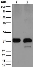 Western blot - Anti-RIMS3 antibody [EPR10117(2)] (AB192602)
