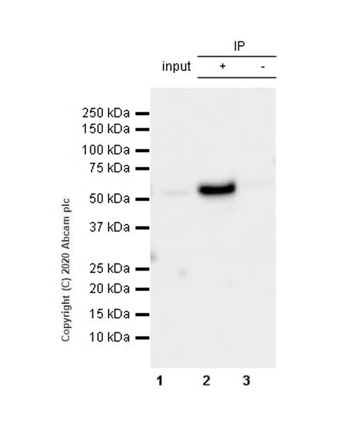 Immunoprecipitation - Anti-RING1 antibody [EPR13047] (AB180170)