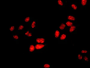 Immunocytochemistry/ Immunofluorescence - Anti-RING1 antibody [EPR13047] - BSA and Azide free (AB250174)