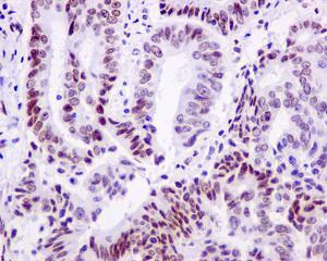 Immunohistochemistry (Formalin/PFA-fixed paraffin-embedded sections) - Anti-RING1 antibody [EPR13047] - BSA and Azide free (AB250174)