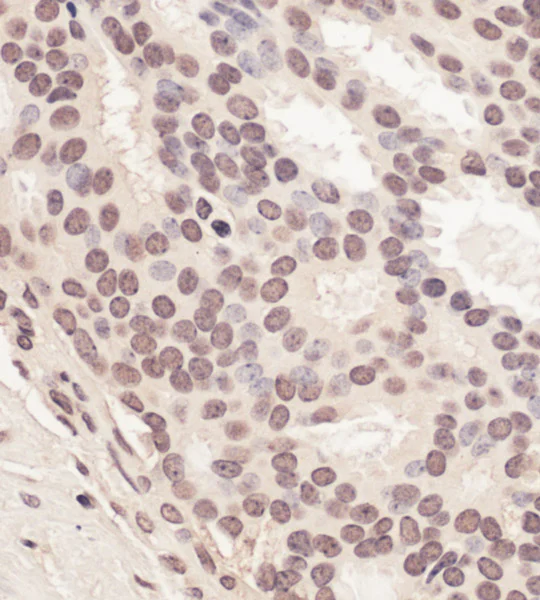 Immunohistochemistry (Formalin/PFA-fixed paraffin-embedded sections) - Anti-RING2 / RING1B / RNF2 antibody (AB101273)