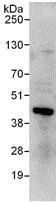 Immunoprecipitation - Anti-RING2 / RING1B / RNF2 antibody (AB101273)