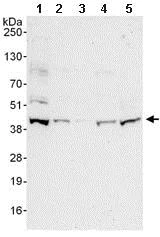 Western blot - Anti-RING2 / RING1B / RNF2 antibody (AB101273)