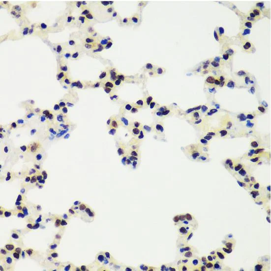 Immunohistochemistry (Formalin/PFA-fixed paraffin-embedded sections) - Anti-RING2 / RING1B / RNF2 antibody (AB187509)