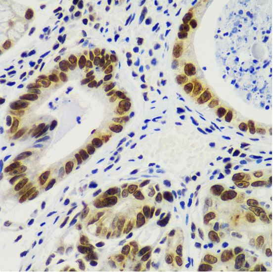 Immunohistochemistry (Formalin/PFA-fixed paraffin-embedded sections) - Anti-RING2 / RING1B / RNF2 antibody (AB187509)