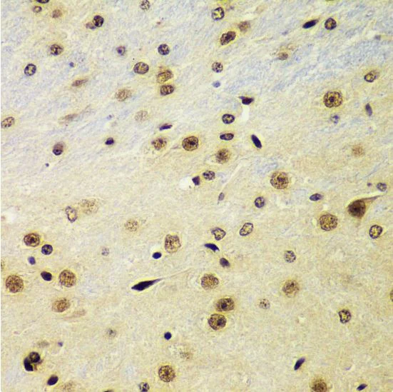 Immunohistochemistry (Formalin/PFA-fixed paraffin-embedded sections) - Anti-RING2 / RING1B / RNF2 antibody (AB187509)