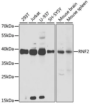Western blot - Anti-RING2 / RING1B / RNF2 antibody (AB187509)