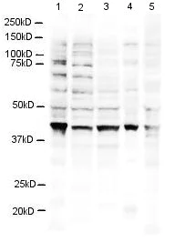Western blot - Anti-RING2 / RING1B / RNF2 antibody (AB3832)