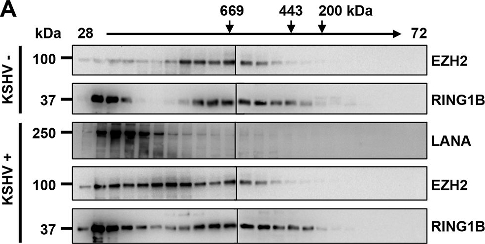 Western blot - Anti-RING2 / RING1B / RNF2 antibody (AB3832)