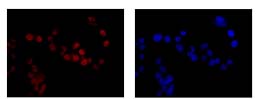 Immunocytochemistry/ Immunofluorescence - Anti-RING2 / RING1B / RNF2 antibody [EPR12245] (ab181140), expandable thumbnail