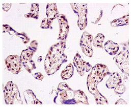 Immunohistochemistry (Formalin/PFA-fixed paraffin-embedded sections) - Anti-RING2 / RING1B / RNF2 antibody [EPR12245] (AB181140), expandable thumbnail