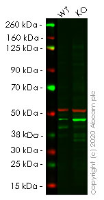 Western blot - Anti-RING2 / RING1B / RNF2 antibody [EPR12245] (AB181140), expandable thumbnail