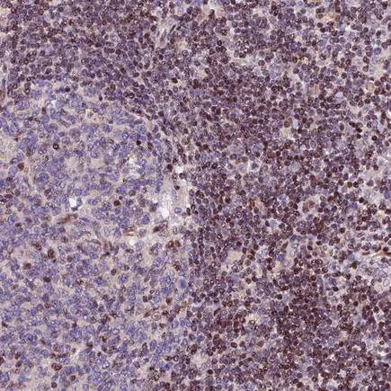 Immunohistochemistry (Formalin/PFA-fixed paraffin-embedded sections) - Anti-RINL antibody (AB243527)