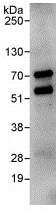 Immunoprecipitation - Anti-RIO2 antibody (AB88485)