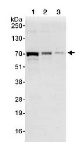 Western blot - Anti-RIO2 antibody (AB88485)