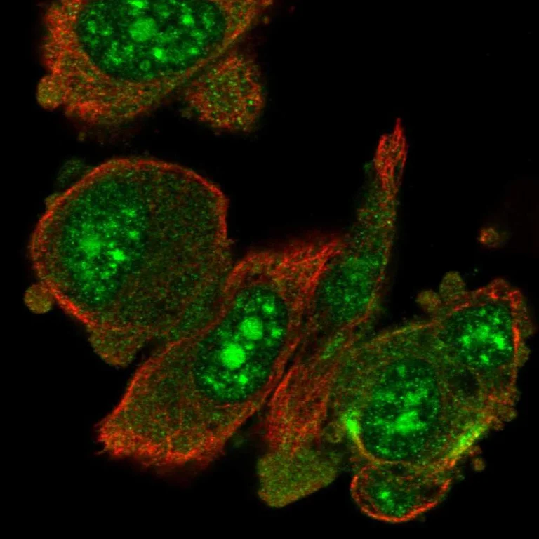 Immunocytochemistry/ Immunofluorescence - Anti-RIOK1/RIO1 antibody (AB254723)