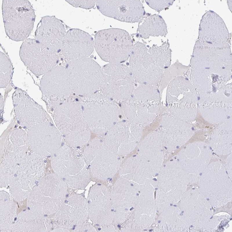 Immunohistochemistry (Formalin/PFA-fixed paraffin-embedded sections) - Anti-RIOK1/RIO1 antibody (AB254723)
