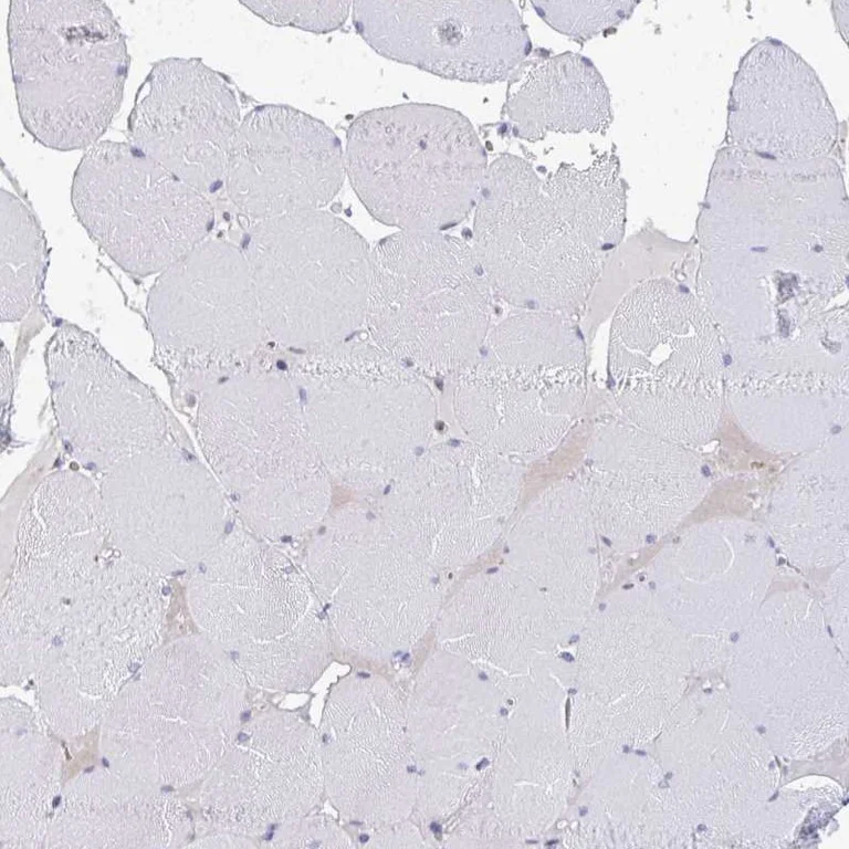 Immunohistochemistry (Formalin/PFA-fixed paraffin-embedded sections) - Anti-RIOK1/RIO1 antibody (AB254723)