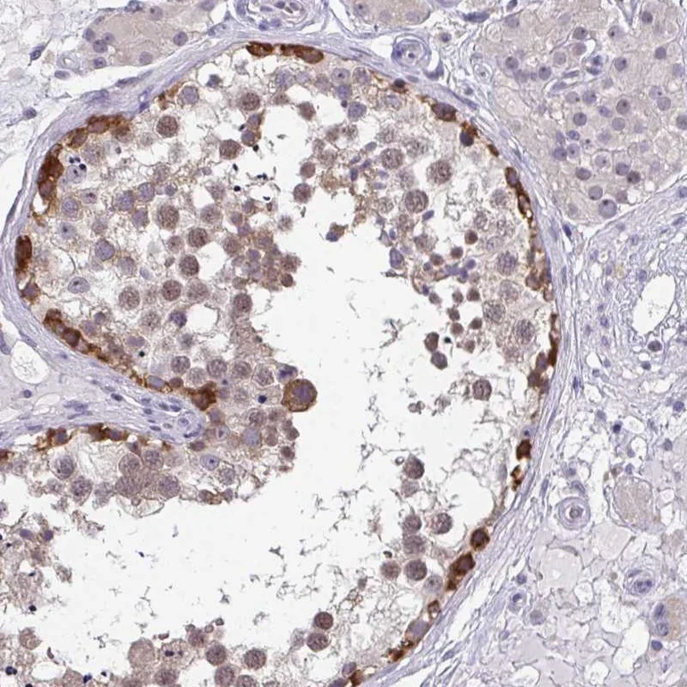 Immunohistochemistry (Formalin/PFA-fixed paraffin-embedded sections) - Anti-RIOK1/RIO1 antibody (AB254723)