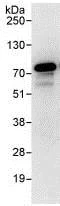 Immunoprecipitation - Anti-RIOK1/RIO1 antibody (AB88496)