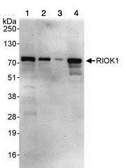 Western blot - Anti-RIOK1/RIO1 antibody (AB88496)