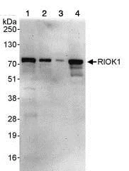 Western blot - Anti-RIOK1/RIO1 antibody (AB88496)