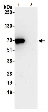Immunoprecipitation - Anti-RIOK3 antibody (AB241361)