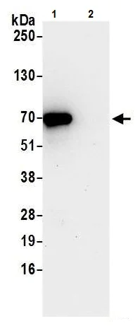 Immunoprecipitation - Anti-RIOK3 antibody (AB241361)