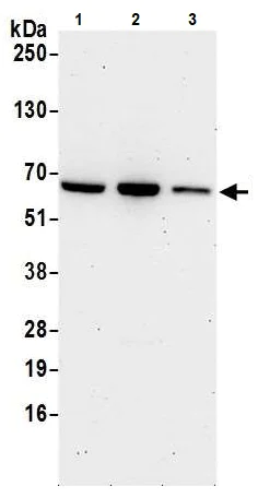 Western blot - Anti-RIOK3 antibody (AB241361)