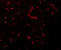Immunocytochemistry/ Immunofluorescence - Anti-RIP antibody (AB106393)