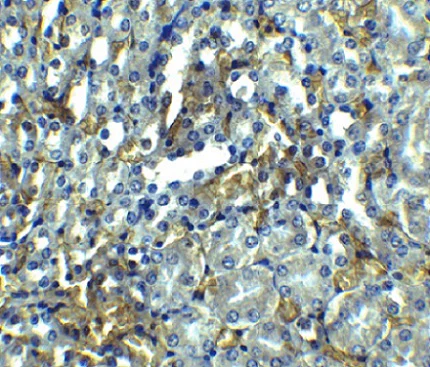 Immunohistochemistry (Formalin/PFA-fixed paraffin-embedded sections) - Anti-RIP antibody (AB106393)