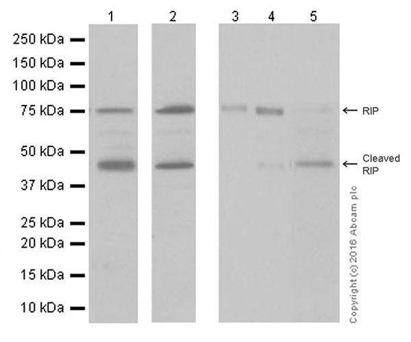 Western blot - Anti-RIP antibody [EPR19697] (AB202985)