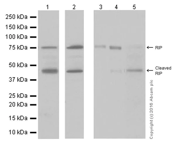 Western blot - Anti-RIP antibody [EPR19697] (AB202985)