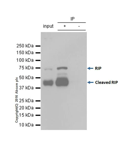 Immunoprecipitation - Anti-RIP antibody [EPR19697] - BSA and Azide free (AB238451)