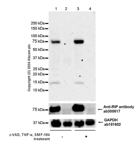 Western blot - Anti-RIP antibody [EPR24883-85] (AB300617)