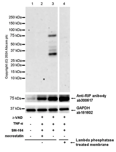 Western blot - Anti-RIP antibody [EPR24883-85] (AB300617)