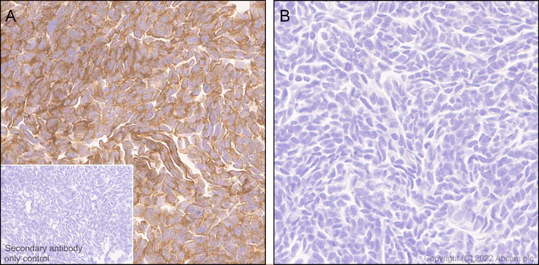 Immunohistochemistry - Anti-RIP antibody [EPR24883-85] (BSA and Azide free) (AB300618)