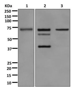 Western blot - Anti-RIP antibody [EPR4689-100] (AB178420)