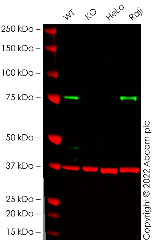 Western blot - Anti-RIP antibody [EPR4689-100] - BSA and Azide free (AB227843)