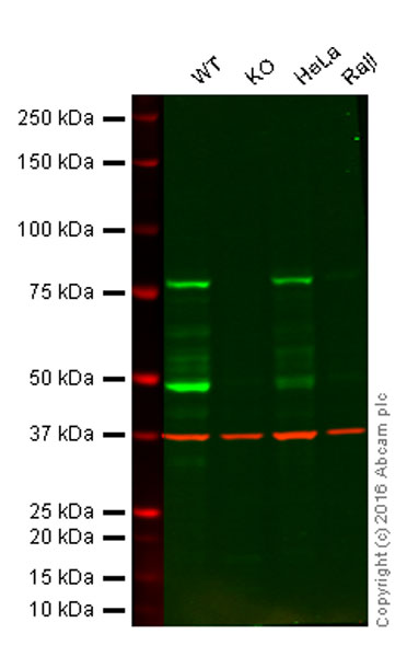 Western blot - Anti-RIP antibody [EPR4689] (AB125072), expandable thumbnail