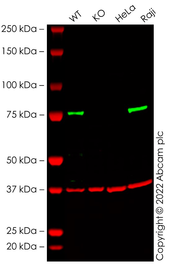 Western blot - Anti-RIP antibody [EPR4689] (ab125072), expandable thumbnail