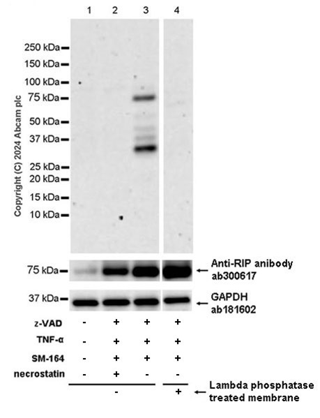 Western blot - Anti-RIP (phospho S166) antibody [EPR25654-166] (AB316923)