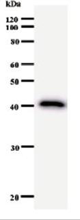 Western blot - Anti-RIP140 antibody [2656C6a] (AB53740), expandable thumbnail
