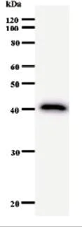 Western blot - Anti-RIP140 antibody [2656C6a] (AB53740)