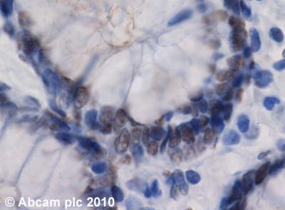 Immunohistochemistry (Formalin/PFA-fixed paraffin-embedded sections) - Anti-RIP140 antibody (AB42126)